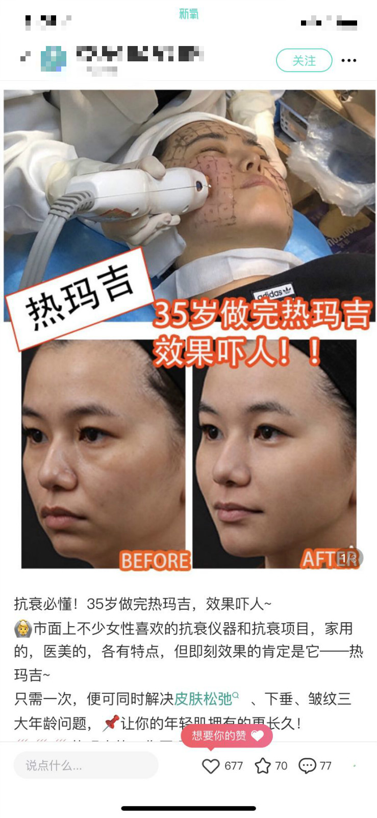 对比效果图.jpg