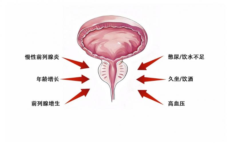 前列腺2.jpg