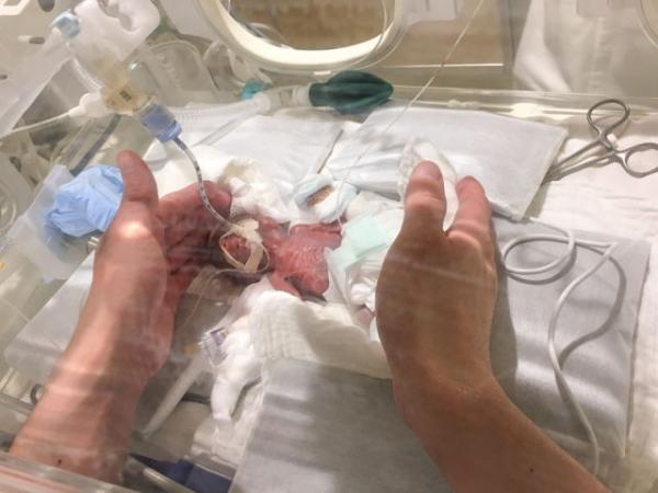 男婴刚出生5天时的资料照片